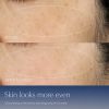 Ake Po Whakatika Serum Duo Tukutahia Maha-Whakaora Arotake Matatini